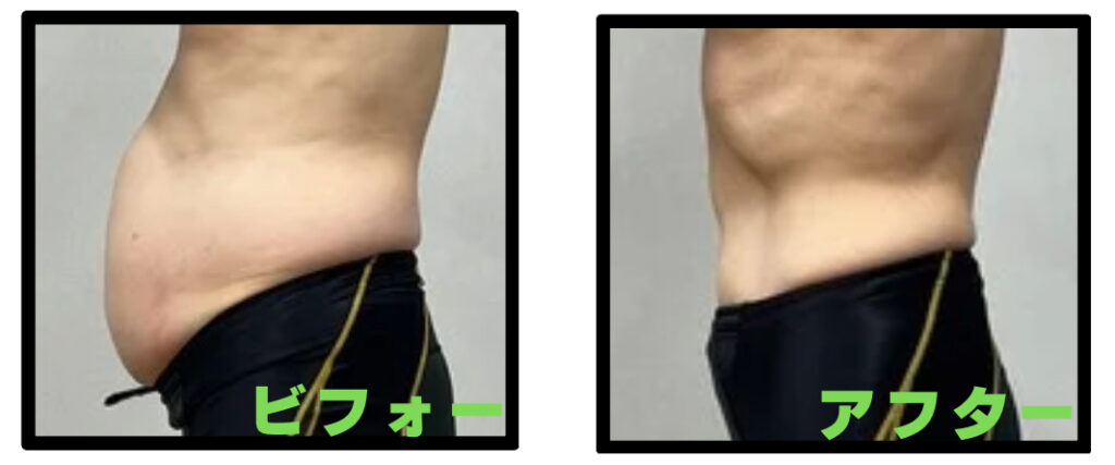 男性でも和歌山市でお腹痩せ