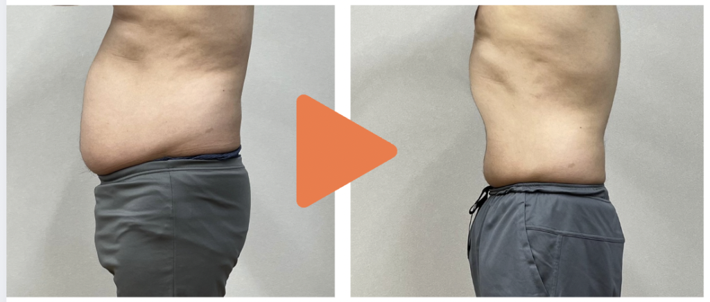 30代男性のお腹痩せ