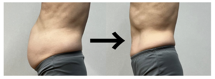 和歌山市でお腹痩せダイエット